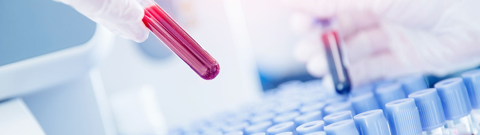 Provetta con plasma in Laboratorio